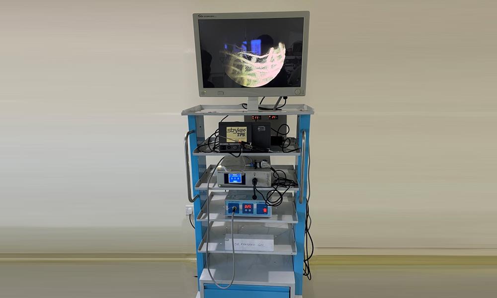 Arthroscopy system