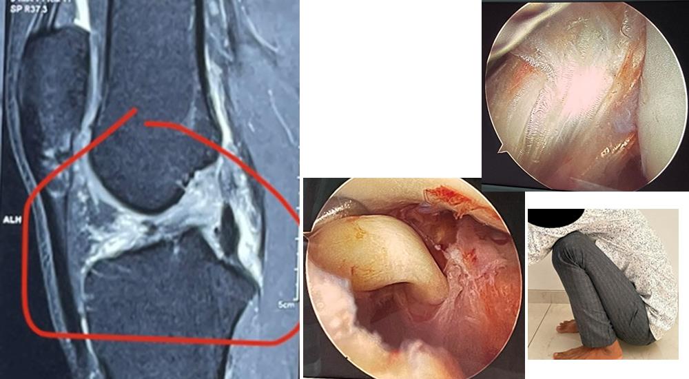 Arthroscopy & Sports Injury