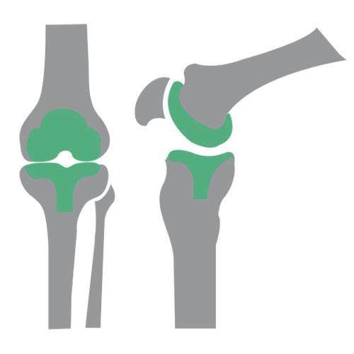 Orthopaedics Superspeciality