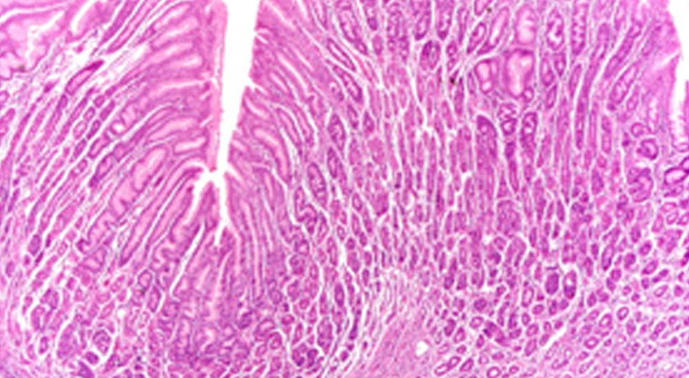 Surgical Pathology 