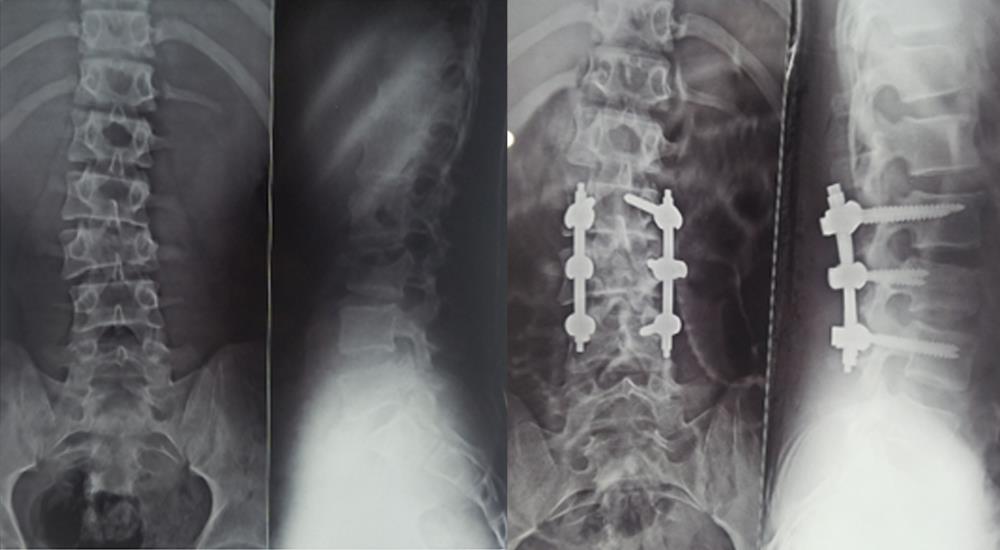 Spine & Arthroscopy