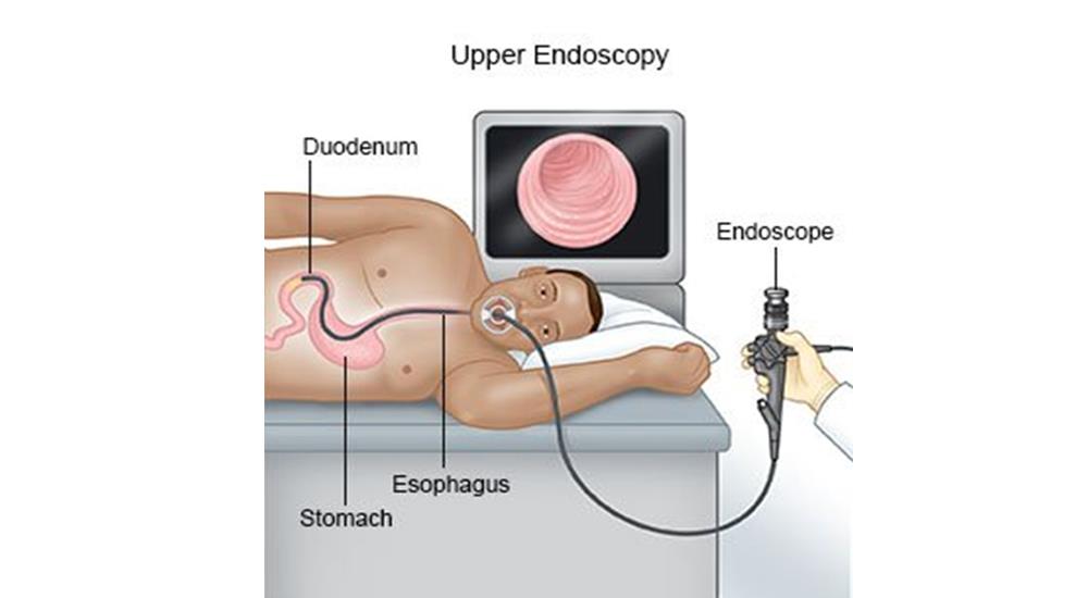 Gastroscopy