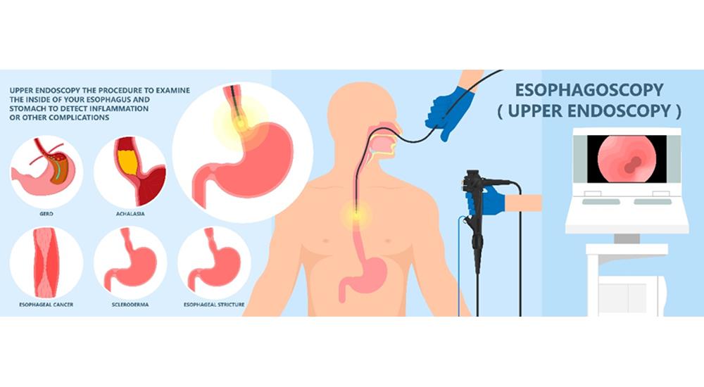 Gastroscopy