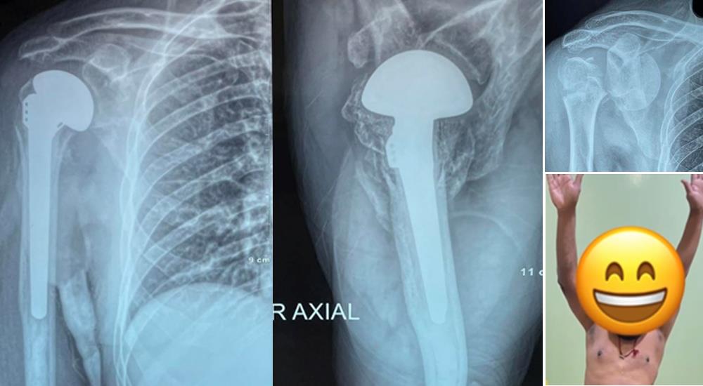 Arthroscopy & Sports Injury